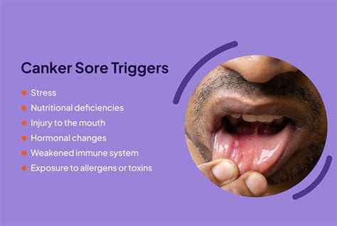 What Diseases Cause Canker Sores